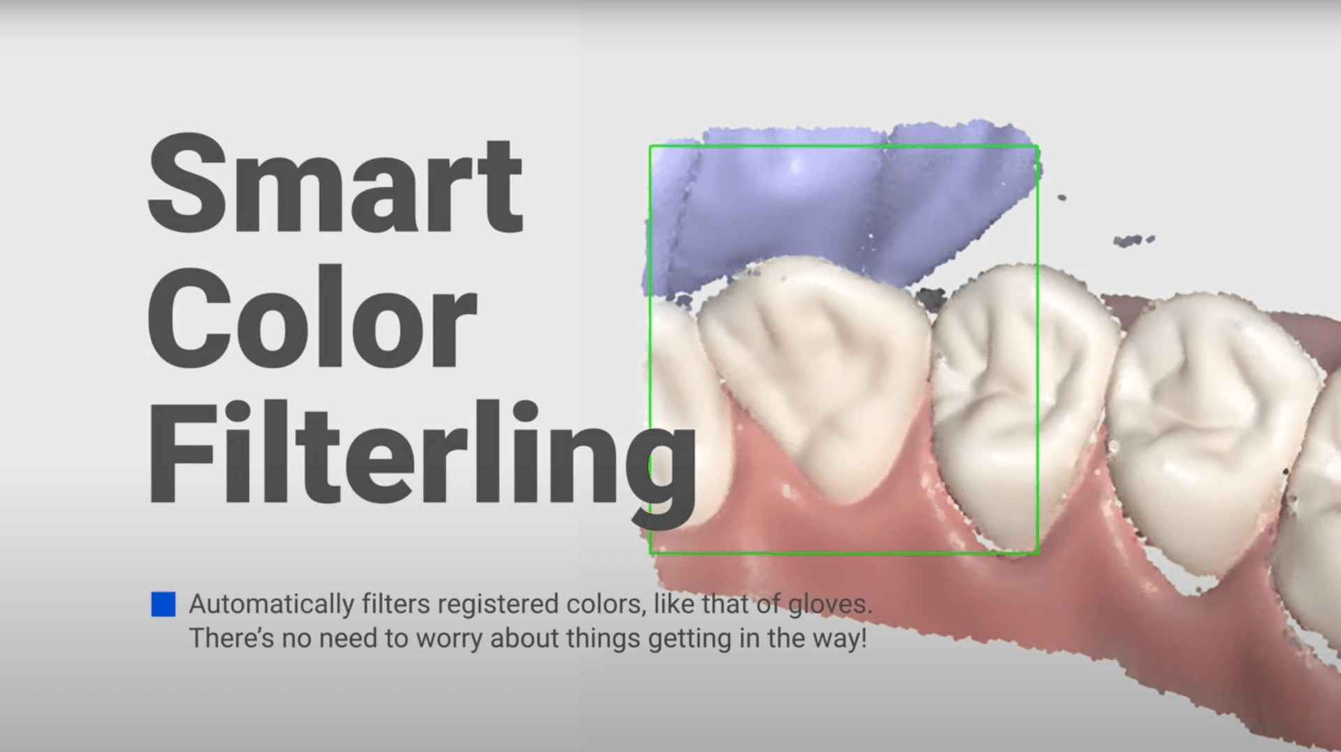 Thumbnail für Smart Color Filtering Medit Link Video