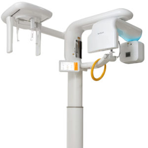 RayScan Alpha